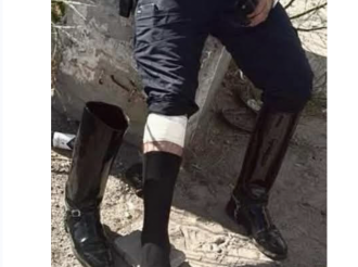 Saben de Que Pata Cojea